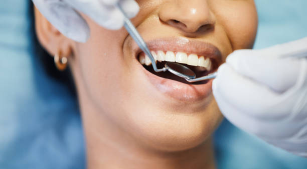 Best Emergency Denture Repair in Mechanicsville, MD